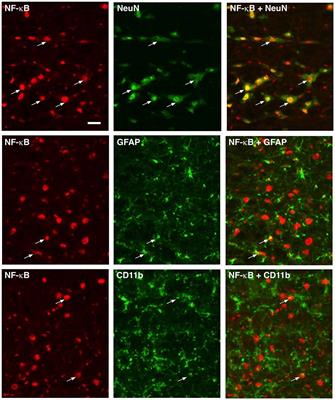 NF-KappaB Pathway Is Involved in Bone Marrow Stromal Cell-Produced Pain Relief